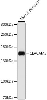 Polyclonal Rabbit anti-Human CEACAM5 / CD66e Antibody (IHC, WB)