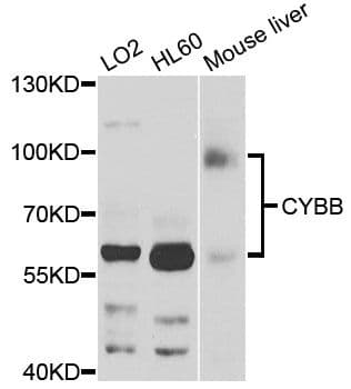 Polyclonal Rabbit anti-Human CYBB / NOX2 / gp91phox Antibody (WB)