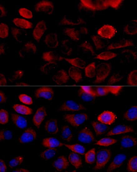 Polyclonal Rabbit anti-Human FGFR2 / FGF Receptor 2 Antibody (IF, WB)