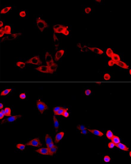 Polyclonal Rabbit anti-Human FGFR2 / FGF Receptor 2 Antibody (IF, WB)