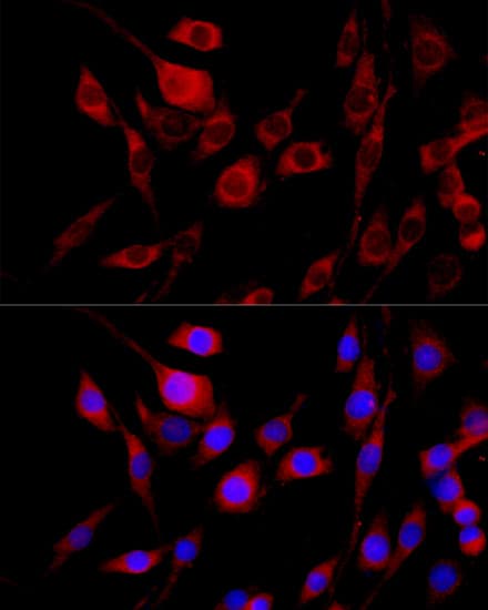 Polyclonal Rabbit anti-Human FGFR2 / FGF Receptor 2 Antibody (IF, WB)