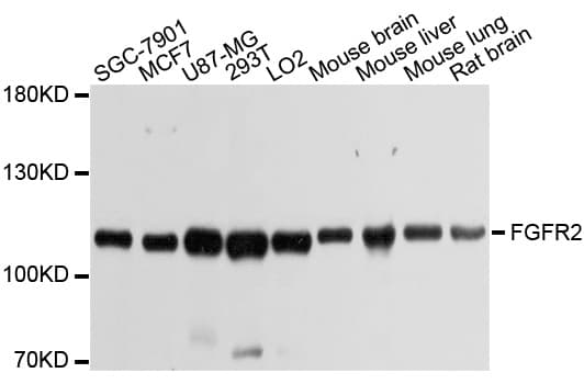 Polyclonal Rabbit anti-Human FGFR2 / FGF Receptor 2 Antibody (IF, WB)