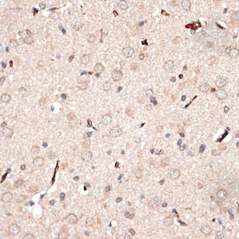 Polyclonal Rabbit anti-Human KTN1 / Kinectin Antibody (IHC, WB)