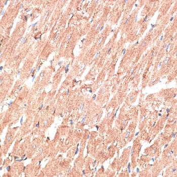 Polyclonal Rabbit anti-Human KTN1 / Kinectin Antibody (IHC, WB)
