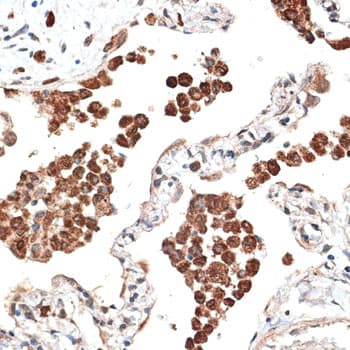 Polyclonal Rabbit anti-Human KTN1 / Kinectin Antibody (IHC, WB)