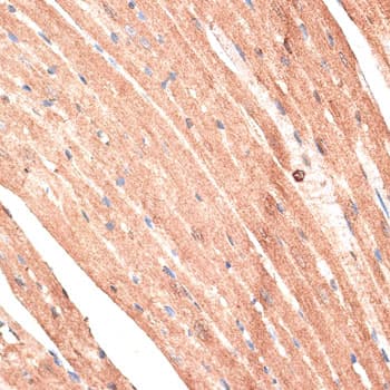 Polyclonal Rabbit anti-Human KTN1 / Kinectin Antibody (IHC, WB)