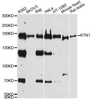 Polyclonal Rabbit anti-Human KTN1 / Kinectin Antibody (IHC, WB)