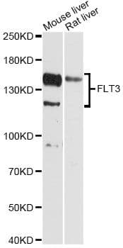Polyclonal Rabbit anti-Human CD135 / FLT3 Antibody (WB)