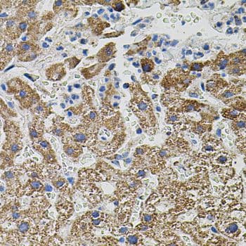 Polyclonal Rabbit anti-Human NTF3 / Neurotrophin 3 Antibody (IHC, WB)