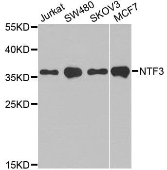 Polyclonal Rabbit anti-Human NTF3 / Neurotrophin 3 Antibody (IHC, WB)
