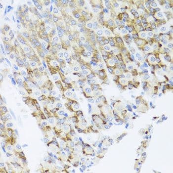 Polyclonal Rabbit anti-Human PIK3CA / PI3K Alpha Antibody (IHC, WB)