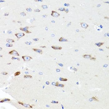 Polyclonal Rabbit anti-Human PIK3CA / PI3K Alpha Antibody (IHC, WB)