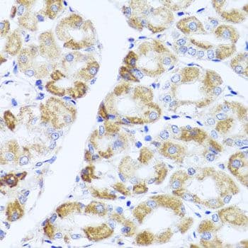 Polyclonal Rabbit anti-Human PIK3CA / PI3K Alpha Antibody (IHC, WB)