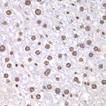 Polyclonal Rabbit anti-Human TOP1 / Topoisomerase I Antibody (IHC, WB)