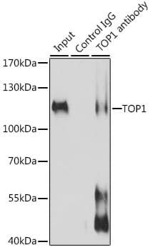 Polyclonal Rabbit anti-Human TOP1 / Topoisomerase I Antibody (IHC, WB)