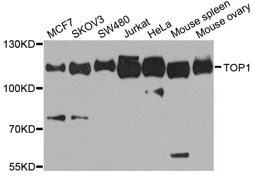 Polyclonal Rabbit anti-Human TOP1 / Topoisomerase I Antibody (IHC, WB)