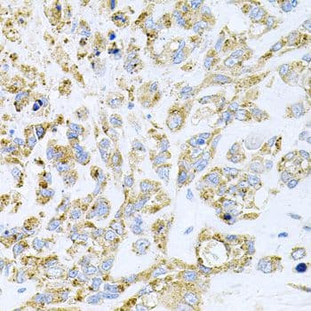 Polyclonal Rabbit anti-Human HDAC3 Antibody (IHC, WB)