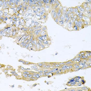 Polyclonal Rabbit anti-Human HDAC3 Antibody (IHC, WB)