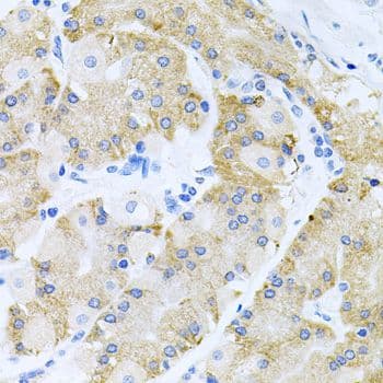 Polyclonal Rabbit anti-Human HDAC3 Antibody (IHC, WB)