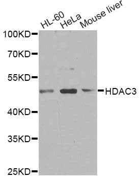 Polyclonal Rabbit anti-Human HDAC3 Antibody (IHC, WB)