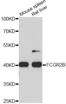 Polyclonal Rabbit anti-Human CD32B Antibody (WB)