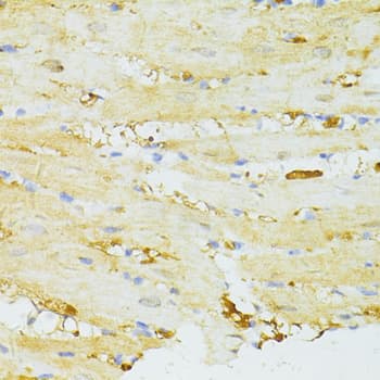 Polyclonal Rabbit anti-Human SIRT2 / Sirtuin 2 Antibody (IHC, WB)