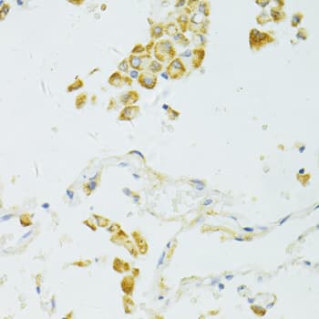 Polyclonal Rabbit anti-Human SIRT2 / Sirtuin 2 Antibody (IHC, WB)