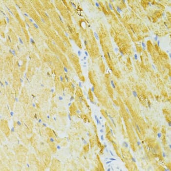 Polyclonal Rabbit anti-Human SIRT2 / Sirtuin 2 Antibody (IHC, WB)