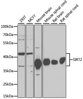 Polyclonal Rabbit anti-Human SIRT2 / Sirtuin 2 Antibody (IHC, WB)