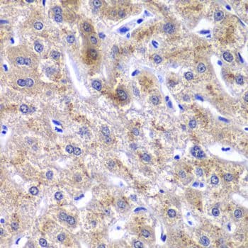 Polyclonal Rabbit anti-Human GOLM1 / GP73 / GOLPH2 Antibody (IHC, IF, WB)