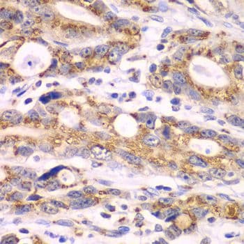 Polyclonal Rabbit anti-Human GOLM1 / GP73 / GOLPH2 Antibody (IHC, IF, WB)