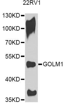 Polyclonal Rabbit anti-Human GOLM1 / GP73 / GOLPH2 Antibody (IHC, IF, WB)