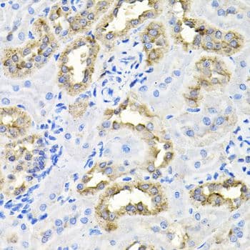 Polyclonal Rabbit anti-Human CDCA8 / Borealin Antibody (IHC, WB)