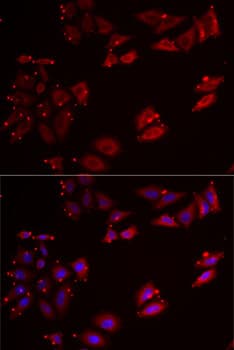 Polyclonal Rabbit anti-Human NKP30 Antibody (IF, WB)