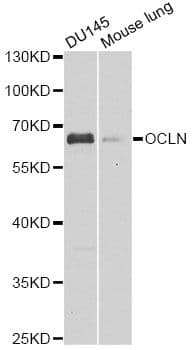 Polyclonal Rabbit anti-Human OCLN / Occludin Antibody (IHC, WB)