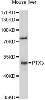 Polyclonal Rabbit anti-Human PTX3 / Pentraxin 3 Antibody (WB)