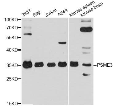 Polyclonal Rabbit anti-Human PSME3 Antibody (WB)