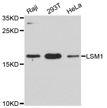Polyclonal Rabbit anti-Human LSM1 Antibody (IHC, WB)