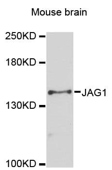 Polyclonal Rabbit anti-Human JAG1 / Jagged 1 Antibody (WB)