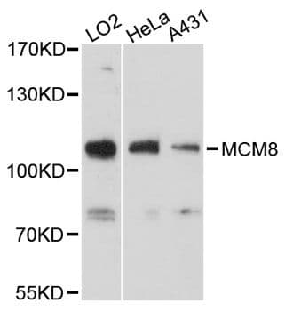 Polyclonal Rabbit anti-Human MCM8 Antibody (WB)
