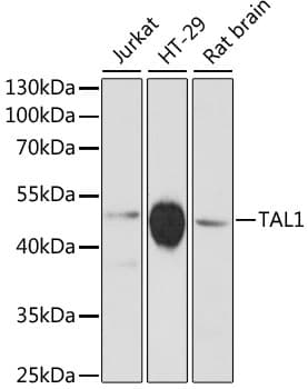 Polyclonal Rabbit anti-Human TAL1 Antibody (WB)