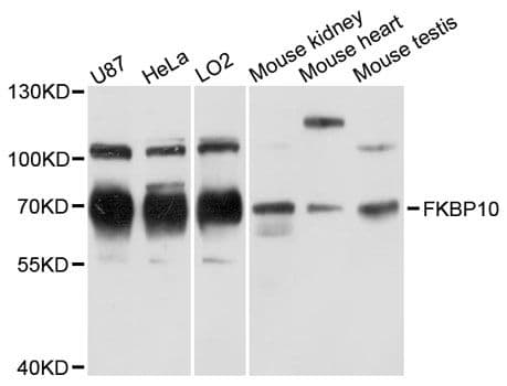 Polyclonal Rabbit anti-Human FKBP10 / FKBP65 Antibody (WB)