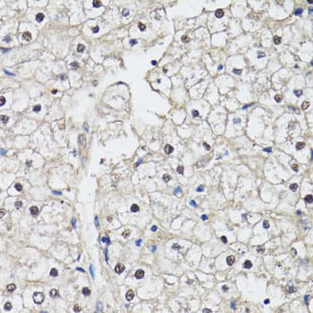 Polyclonal Rabbit anti-Human CDK7 Antibody (IHC, WB)