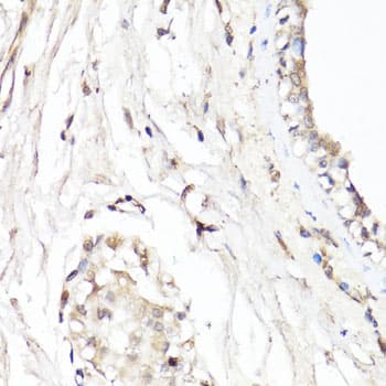 Polyclonal Rabbit anti-Human CDK7 Antibody (IHC, WB)