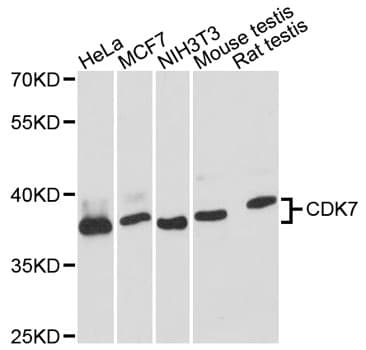 Polyclonal Rabbit anti-Human CDK7 Antibody (IHC, WB)