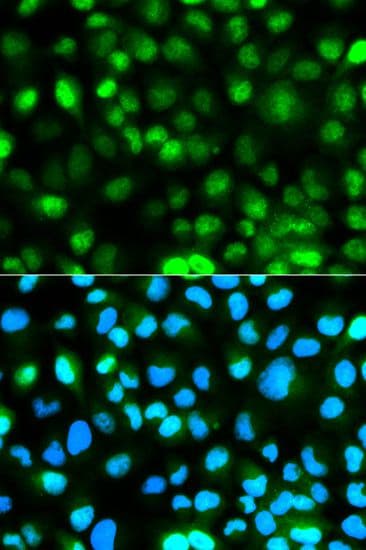 Polyclonal Rabbit anti-Human ATXN3 / JOS Antibody (IF, WB)