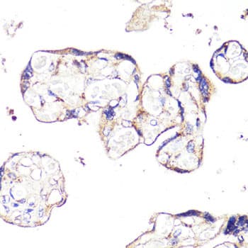 Polyclonal Rabbit anti-Human IGF2R / CD222 Antibody (IHC, IF, WB)