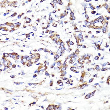 Polyclonal Rabbit anti-Human IGF2R / CD222 Antibody (IHC, IF, WB)