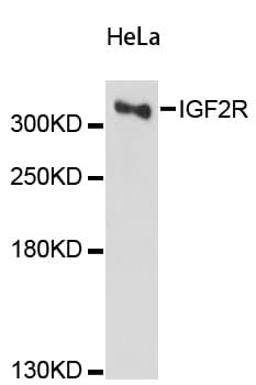 Polyclonal Rabbit anti-Human IGF2R / CD222 Antibody (IHC, IF, WB)