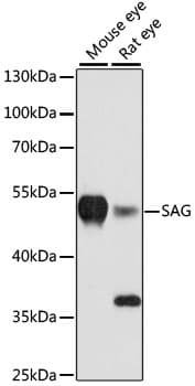 Polyclonal Rabbit anti-Human SAG / Arrestin Antibody (WB)